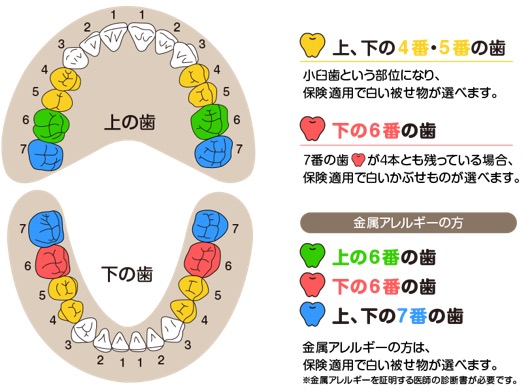 保険の白いかぶせもの